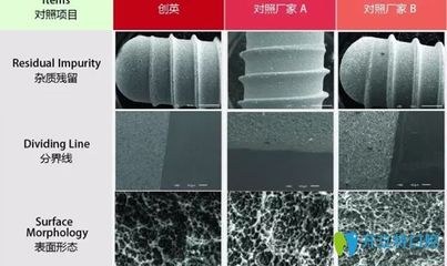 国产种植牙系统新星 创英种植牙系统的优势与研究所技术实力解析